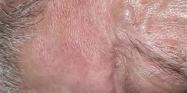 molten